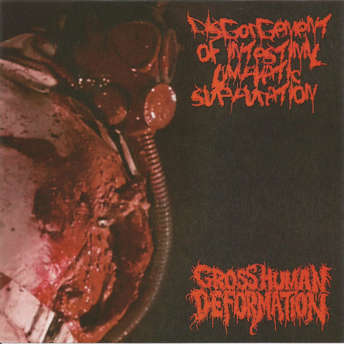 Disgorgement Of Intestinal Lymphatic Suppuration : Disgorgement of Intestinal Lymphatic Suppuration - Gross Human Deformation